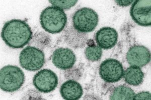 ¿Brote de hantavirus en un crucero puede convertirse en una epidemia? OMS responde